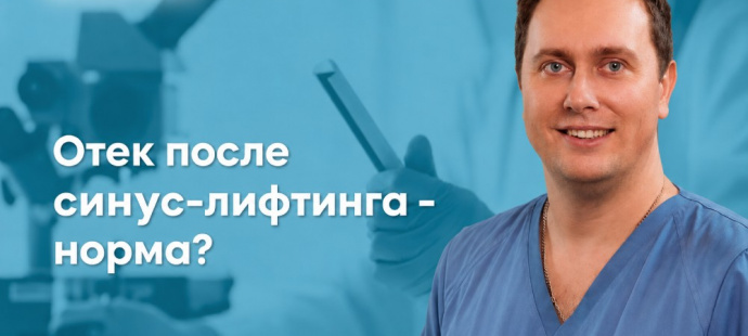 Отек после синус-лифтинга: сколько держится, что считается нормой и когда обращаться к врачу?